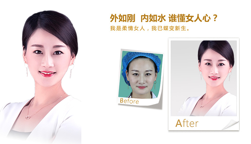 泉州V脸、线雕隆鼻